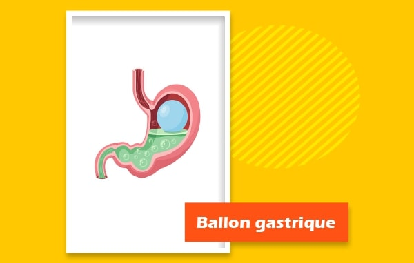 Ballon gastrique