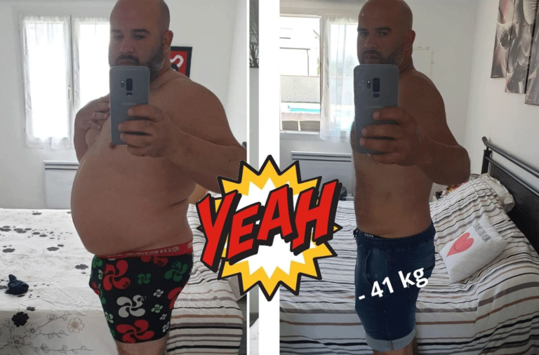 Bypass Gastrique Tunisie Pontage Gastrique Prix Pas Cher Devis Gratuit