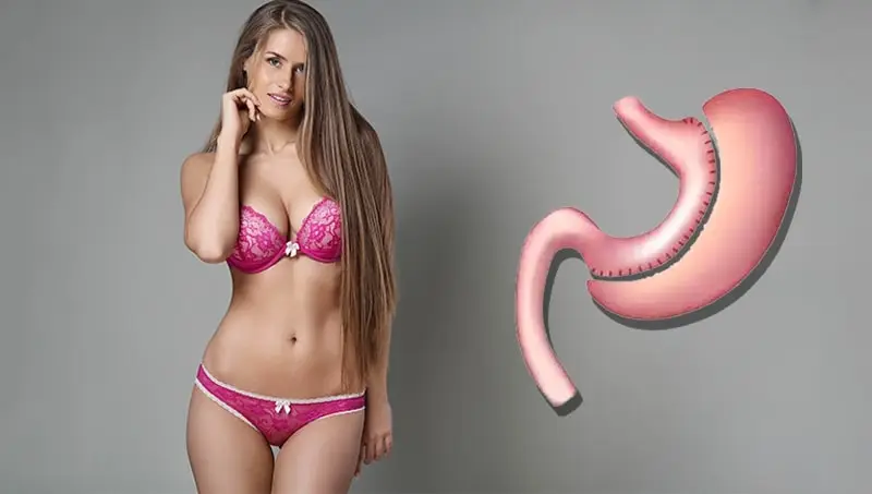 Après une Sleeve Gastrique